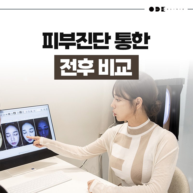 피부 두께