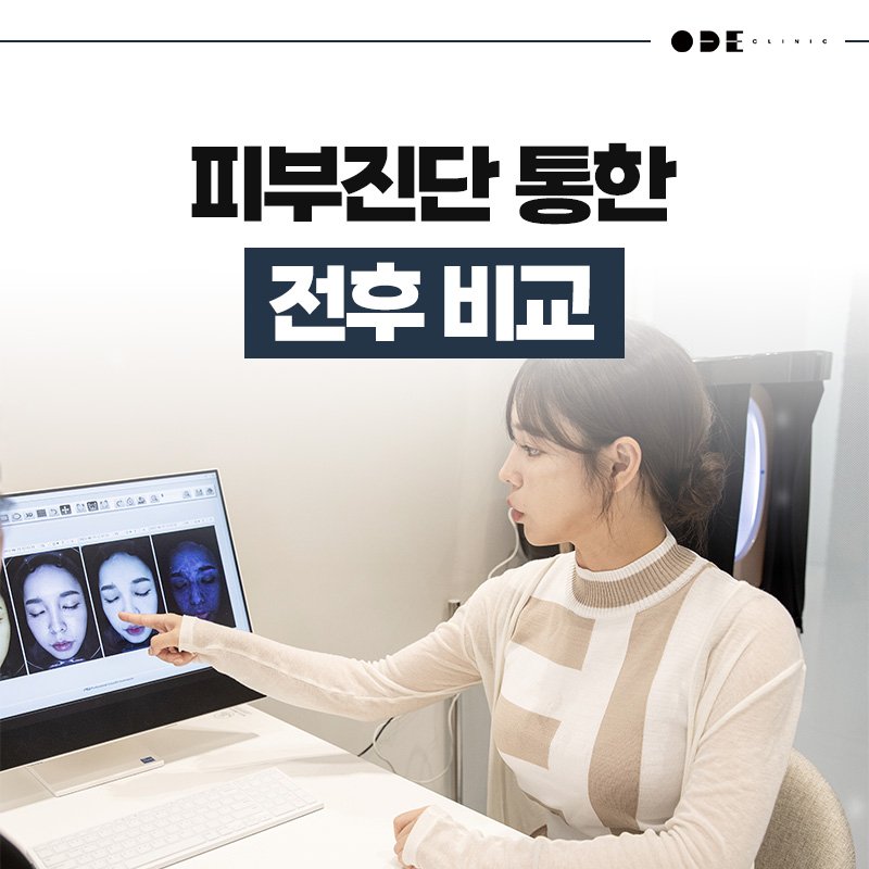 강남 스컬트라 후기